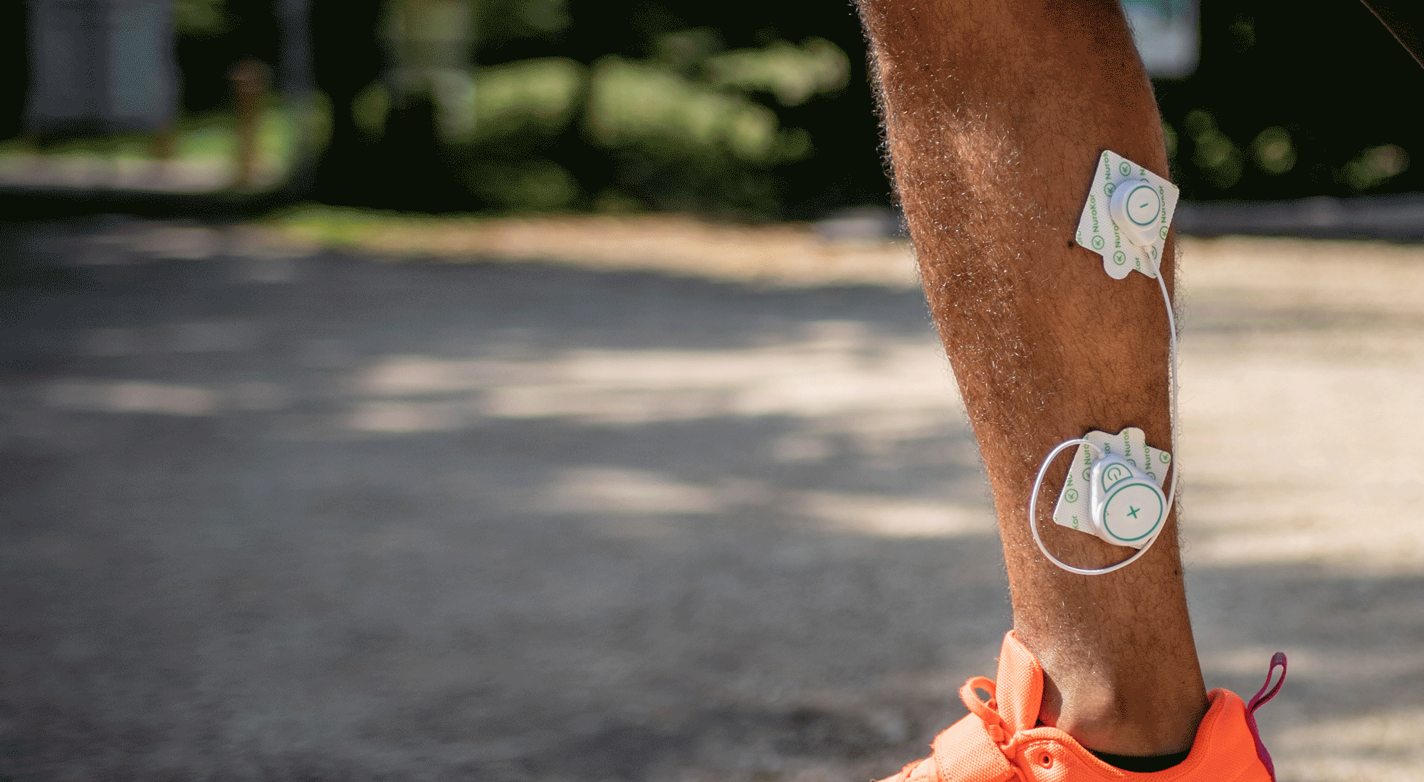 mobidy device radiating waves of neuromuscular stimulation, peripheral nerve stimulation.